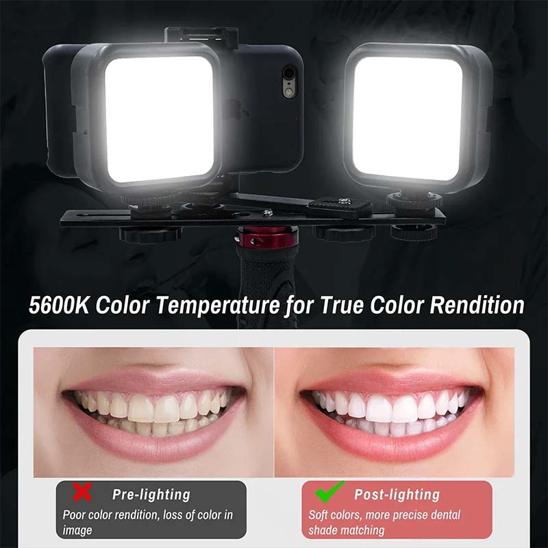 Luz de fotografía dental con i - Photography Lighting Material reseña y precio